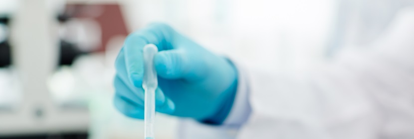 烯基磺酸鈉檢測