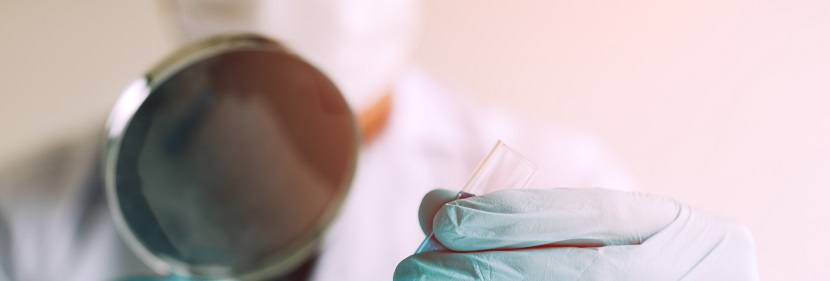 牙科修復(fù)體用聚合物基粘接劑檢測