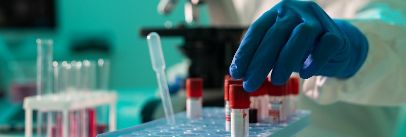 氯烴基硅烷偶聯(lián)劑檢測(cè)