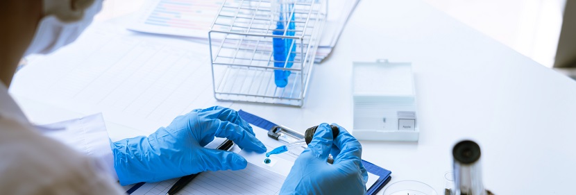 動(dòng)力鋰電池用橡膠密封件檢測(cè)