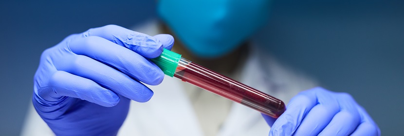 2,4-二叔丁基苯酚檢測(cè)